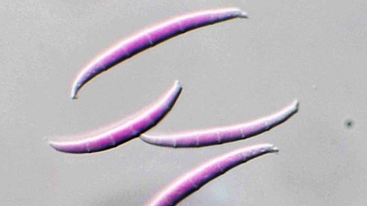 392481-fusarium-graminearum_opt